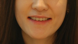수술 후