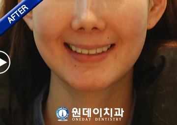 수술 후