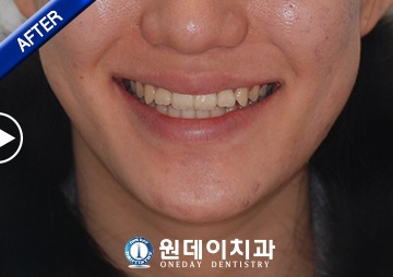 수술 후