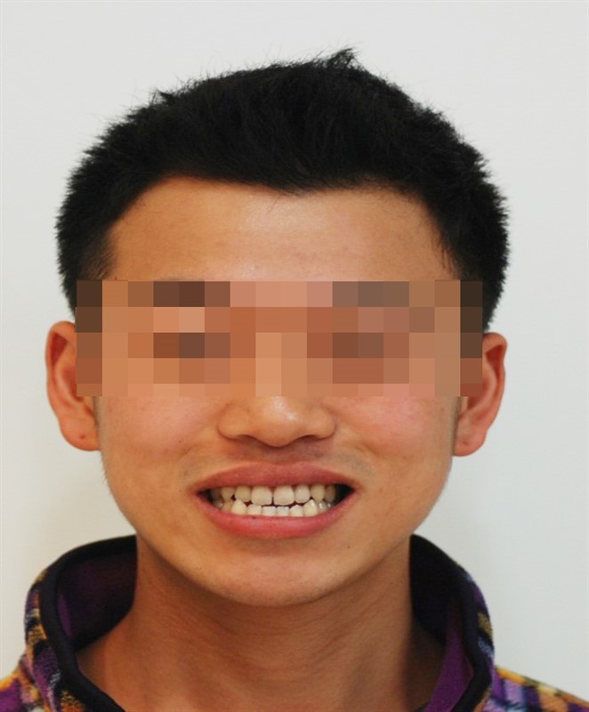 수술 전